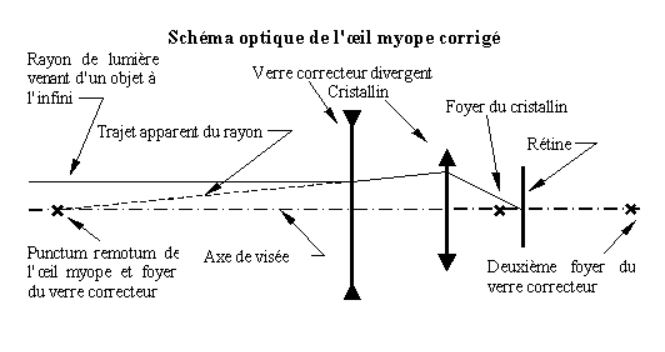 Myope discount sans lunette